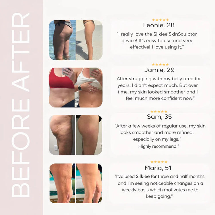 VeloraTone™ Anti-Cellulite Therapy Device