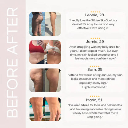 VeloraTone™ Anti-Cellulite Therapy Device